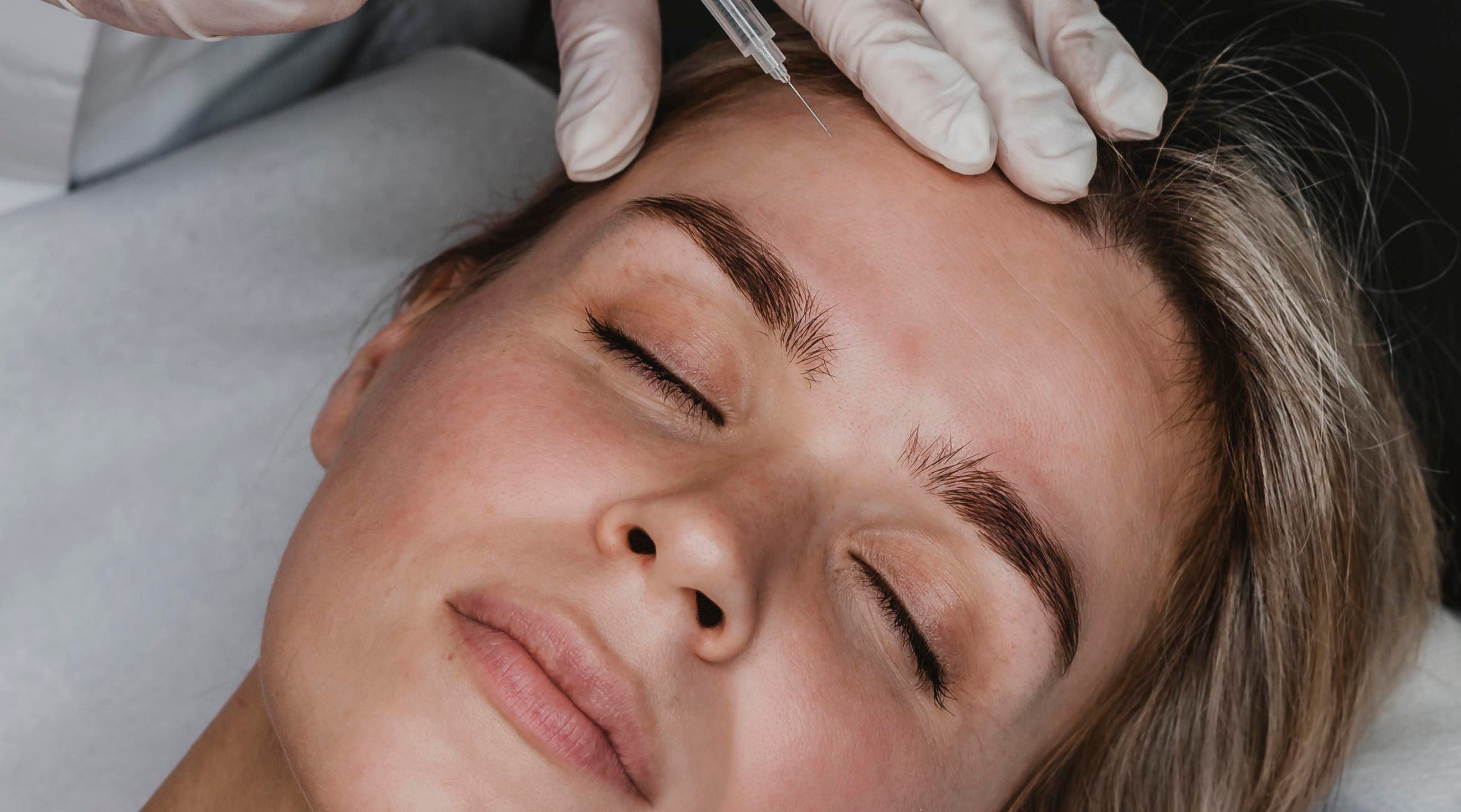 Close up of a young woman receiving a cosmetic injectable in her forehead.